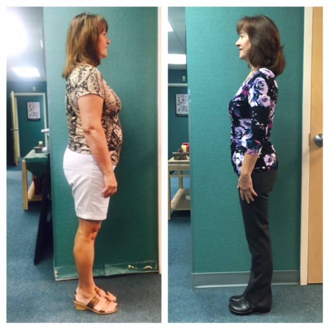 Woman Standing Sideways — Lady Lake, FL  — RN Medical Laser & Weight Loss