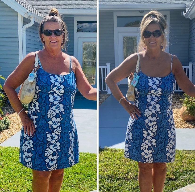 Woman Wearing A Blue Dress And Black Shade  — Lady Lake, FL  — RN Medical Laser & Weight Loss