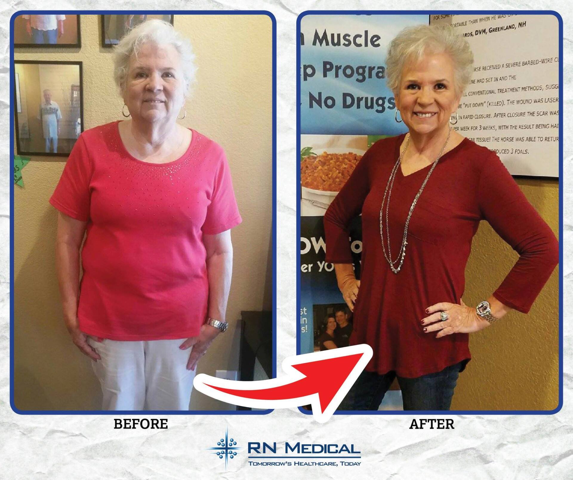 Woman With Arrow Left — Lady Lake, FL  — RN Medical Laser & Weight Loss
