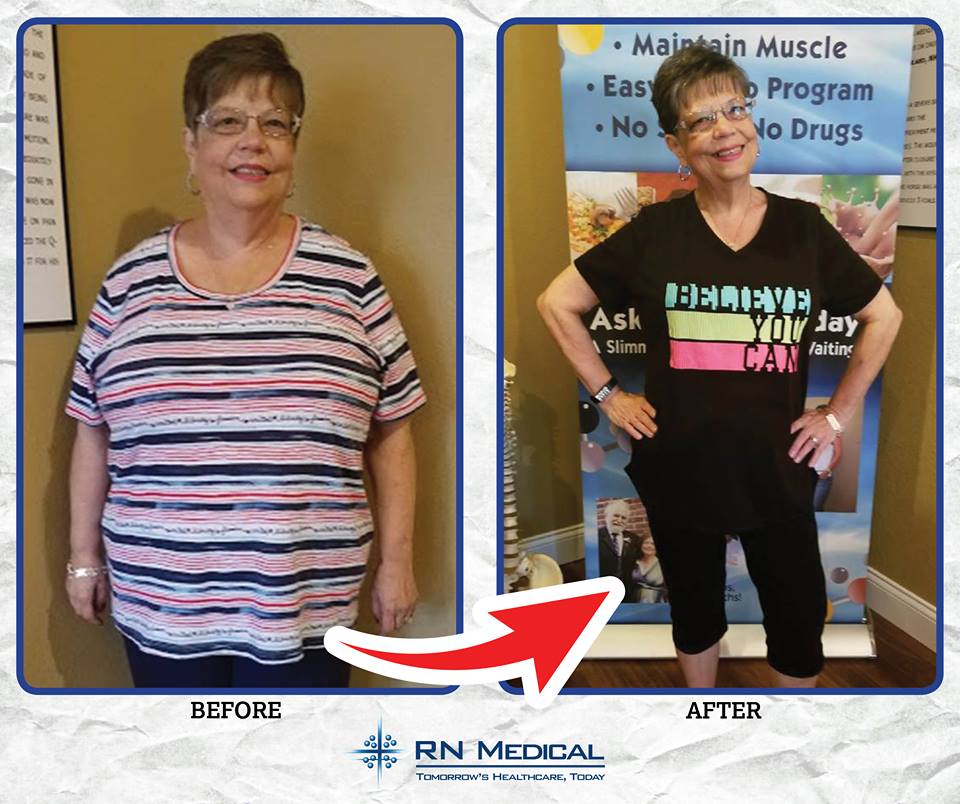 Picture Of Woman Satisfy Of The Result — Lady Lake, FL  — RN Medical Laser & Weight Loss