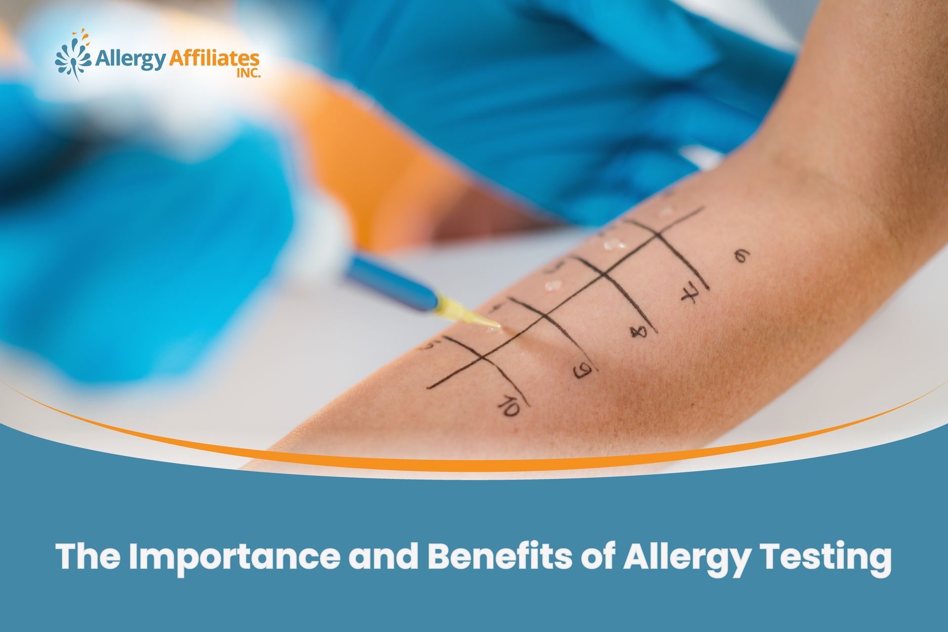The Importance and Benefits of Allergy Testing