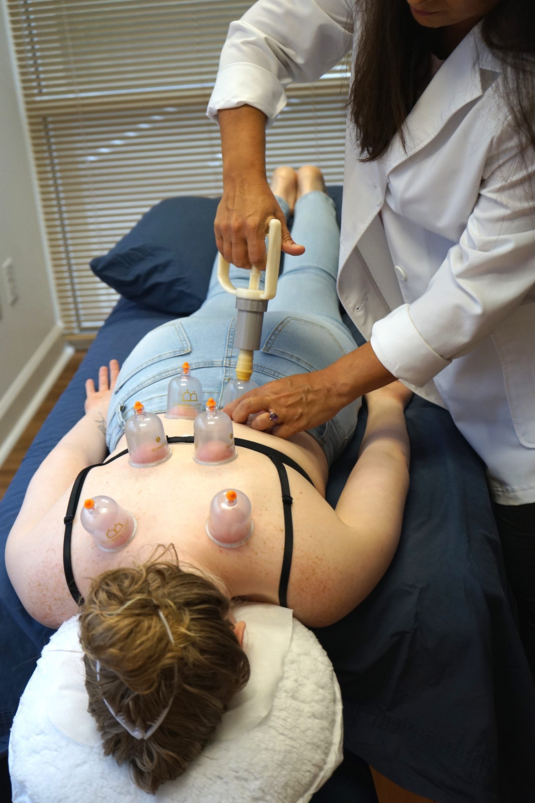 Receiving vacuum cupping therapy treatment.