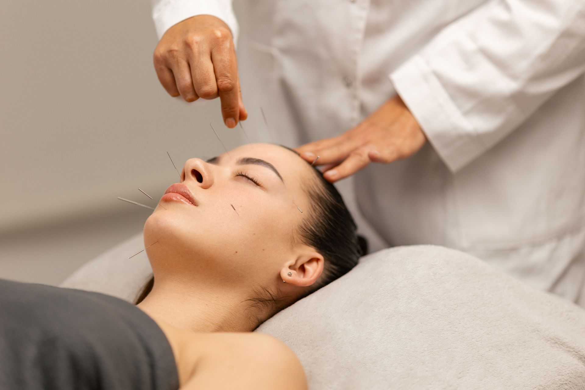 A woman is getting an acupuncture treatment on her face.