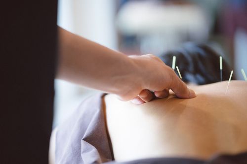 A woman is getting acupuncture on her forehead.