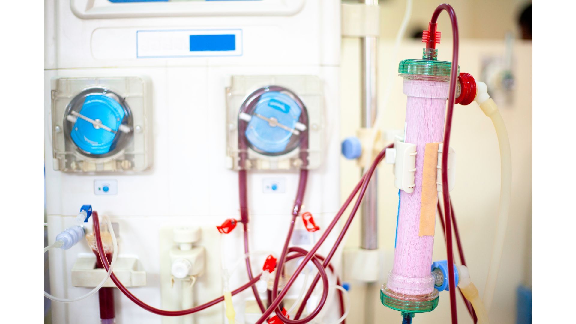 Dialysis in El Paso.