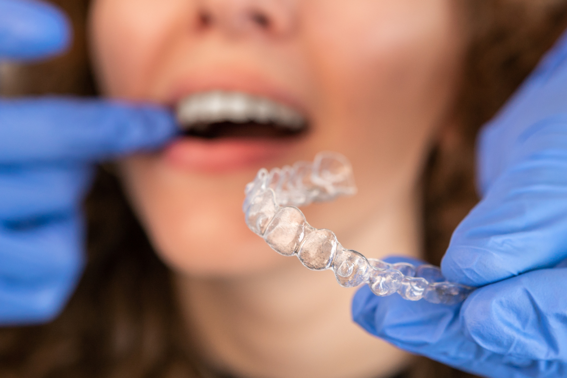 a woman with braces on her teeth is holding a clear retainer in her mouth