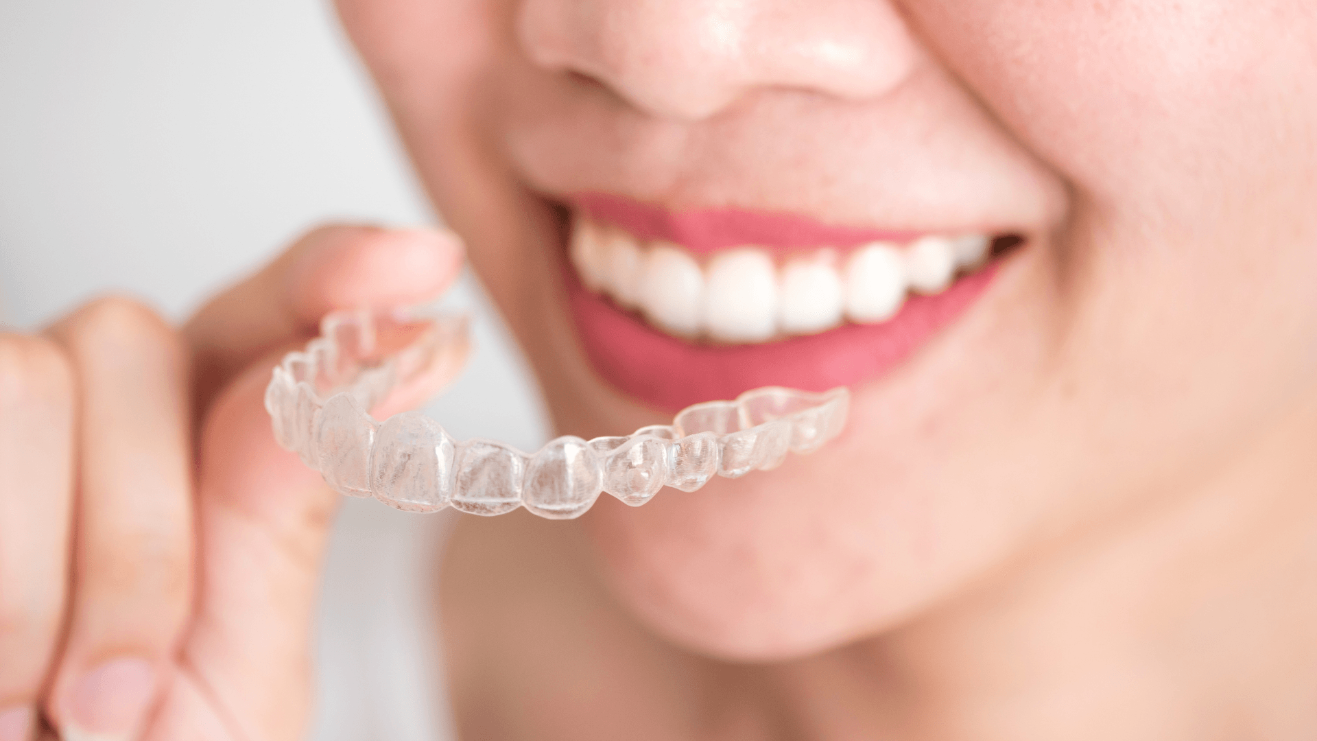 Know About Invisalign
