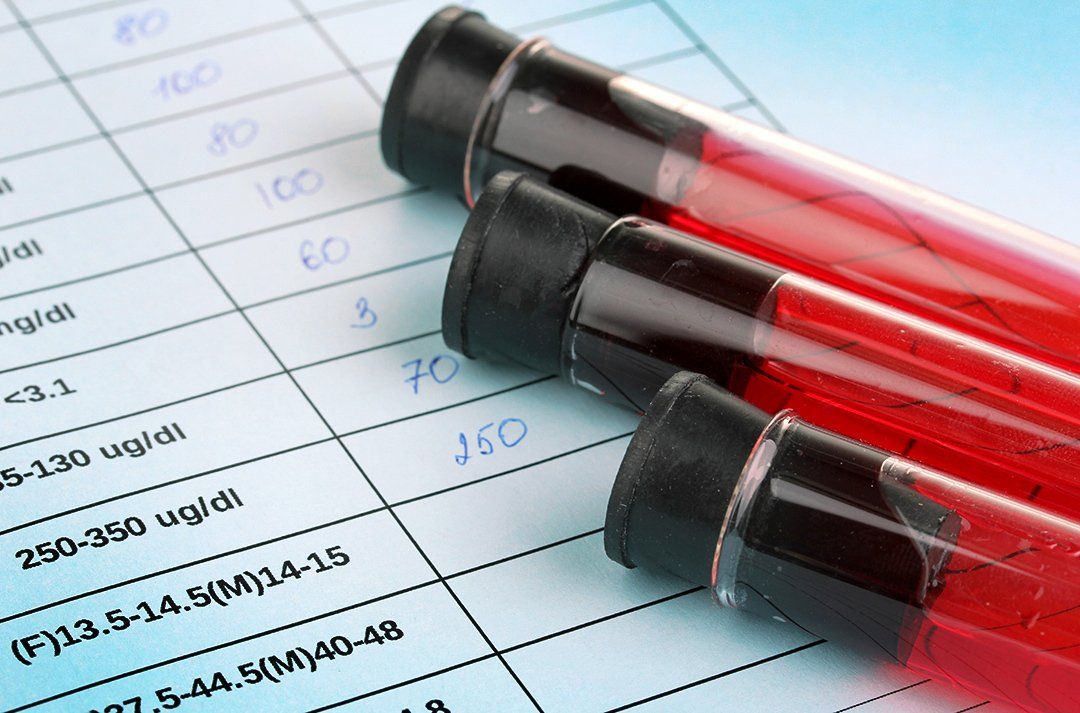 Blood sample vials on lab report