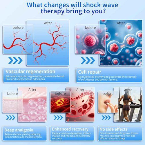 Infographic comparing shock wave therapy before-and-after effects on blood vessels, cells, pain relief, and recovery
