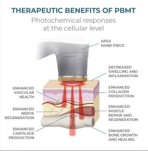 Diagram of PBMT therapeutic benefits showing red light on tissue and labeled cell-level healing effects