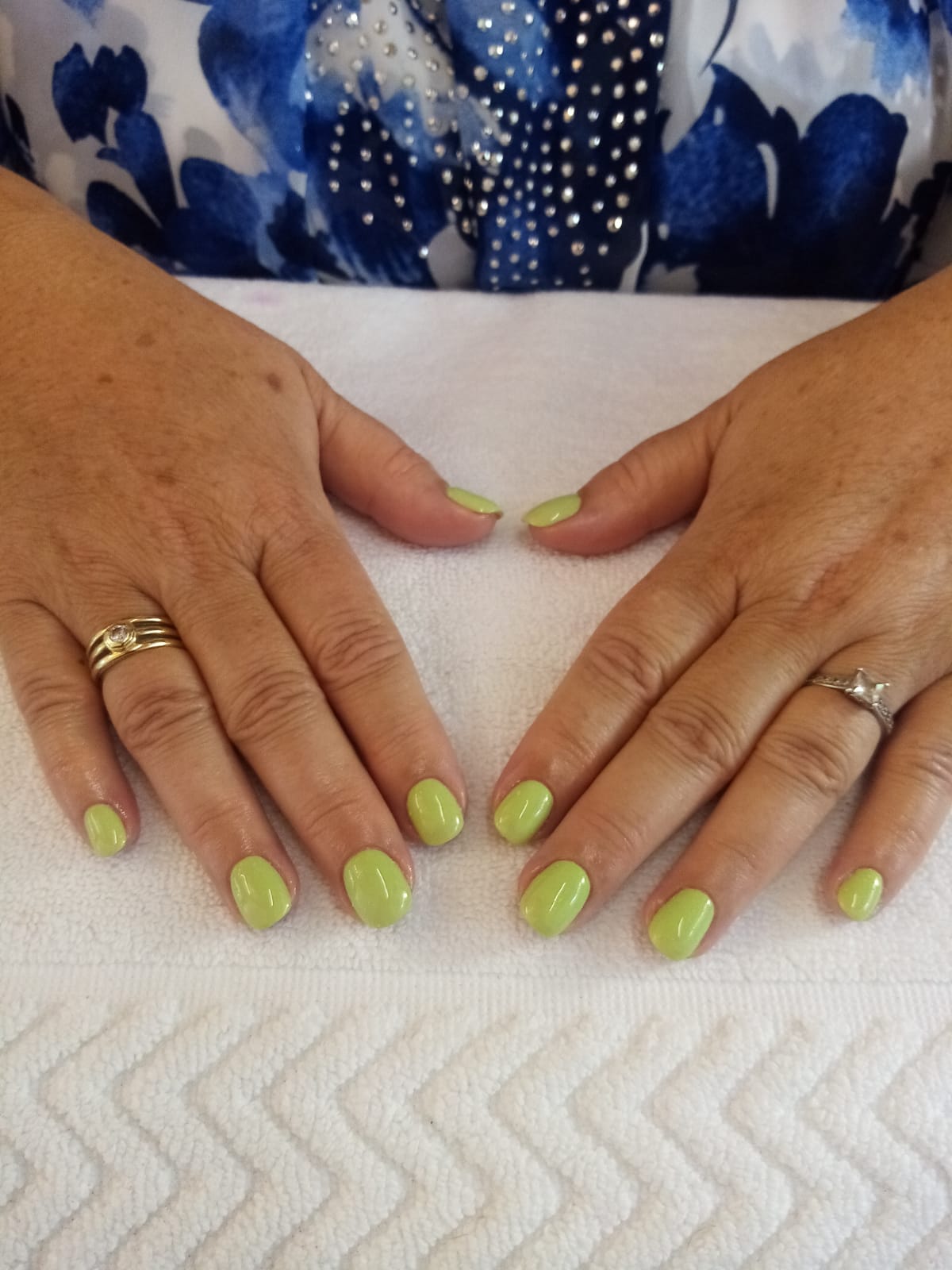 A woman 's hands with yellow nails and rings on them