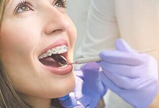 Best Dentist Maryland — Woman With Braces in Cumberland, MD