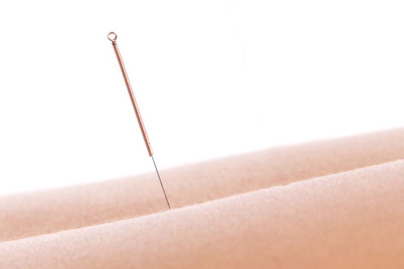 Acupuncture for fertility by Jennie Chews Essence of Healing in Grays, Thurrock