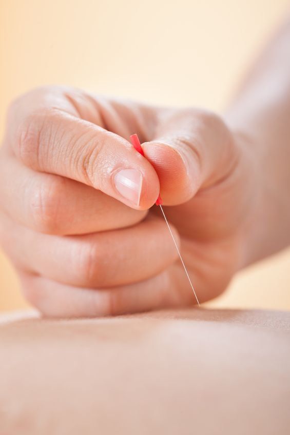 Acupuncture by Jennie Chew of Essence of Healing in Chafford Hundred Grays