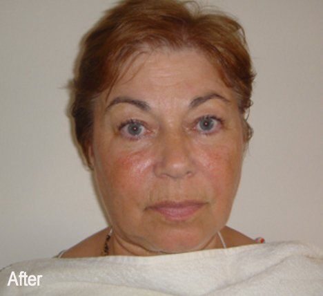 A close up of a woman 's face with the caption after