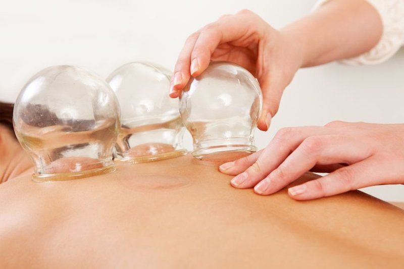 Cupping by Jennie Chews Essence of Healing in Grays, Thurrock