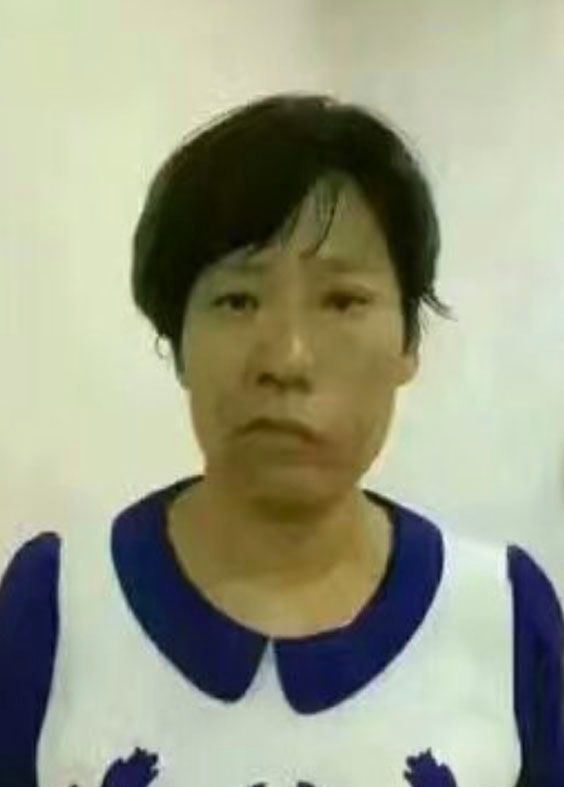 facial paralysis after Bioenergetic Meridians Massager treatment