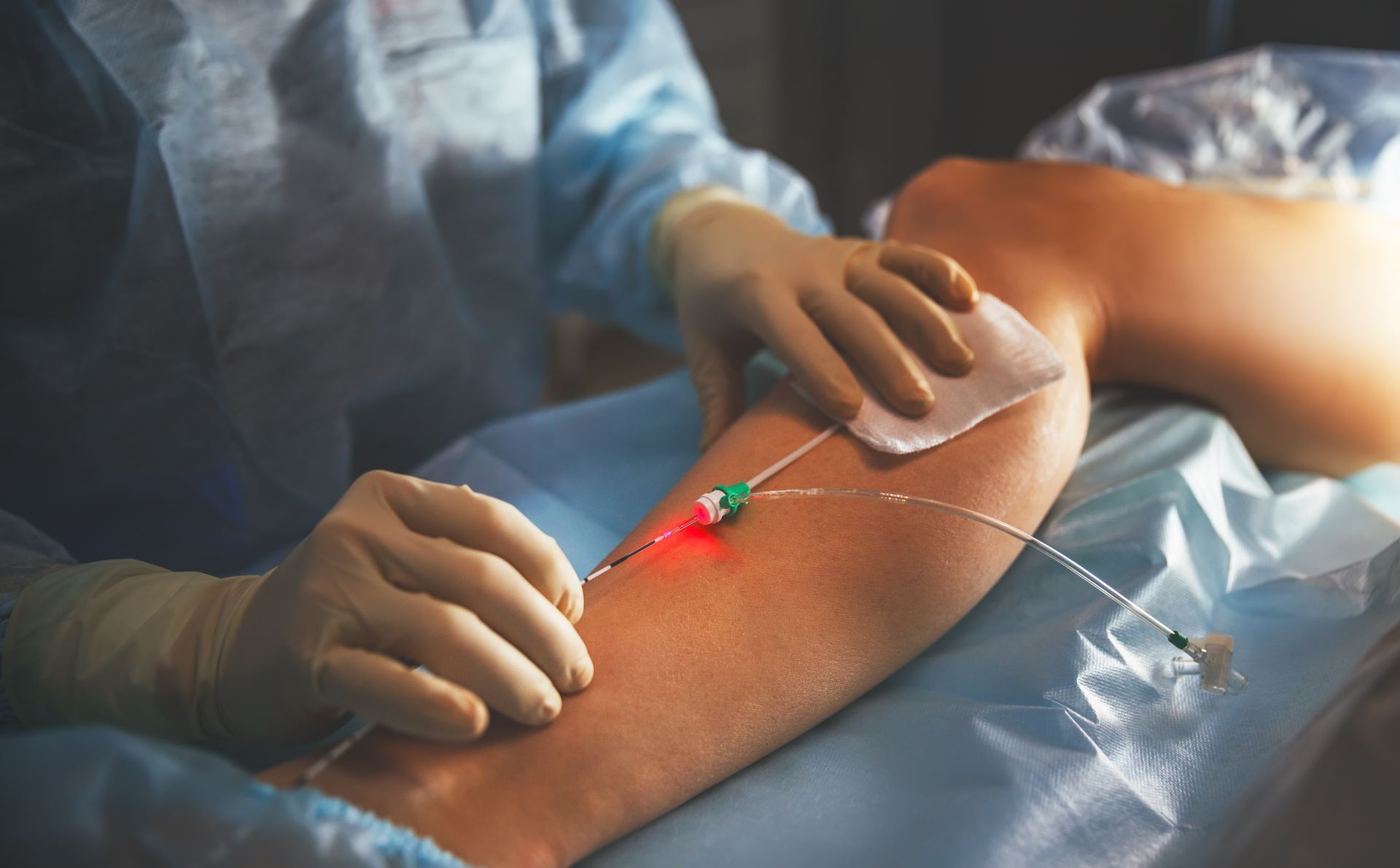 Medical procedure with a catheter inserted into a patient’s arm under sterile conditions. Medical procedure with a catheter inserted into a patient’s arm under sterile conditions.