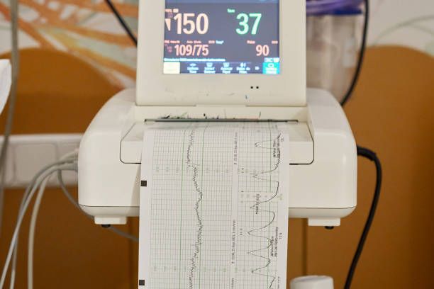 EKG Cardiotocograph having indicators on display and recording controlled data on running paper.