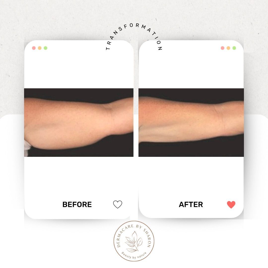 Een voor en na foto van de arm van een vrouw