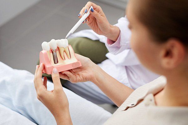 Implant Dentistry