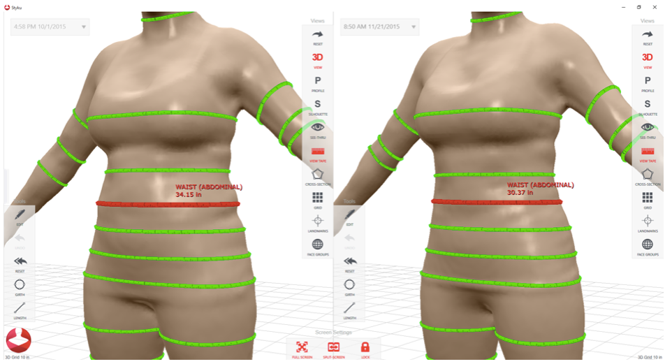 3 doby scanning