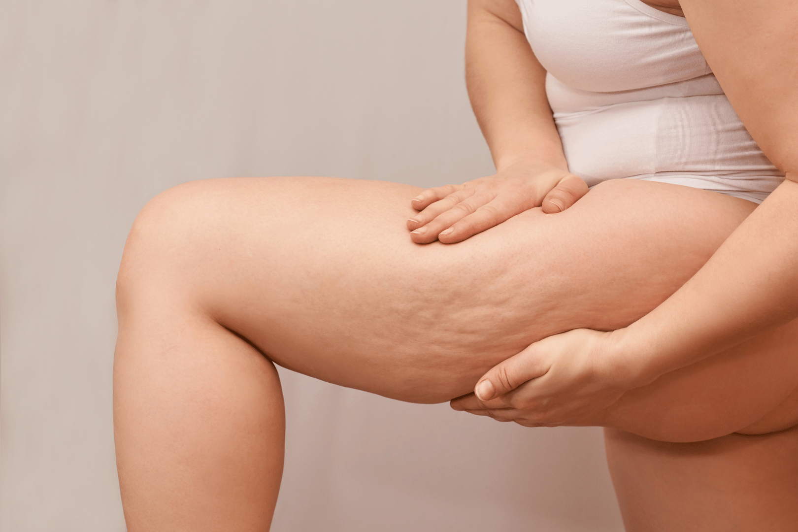 woman with cellulite