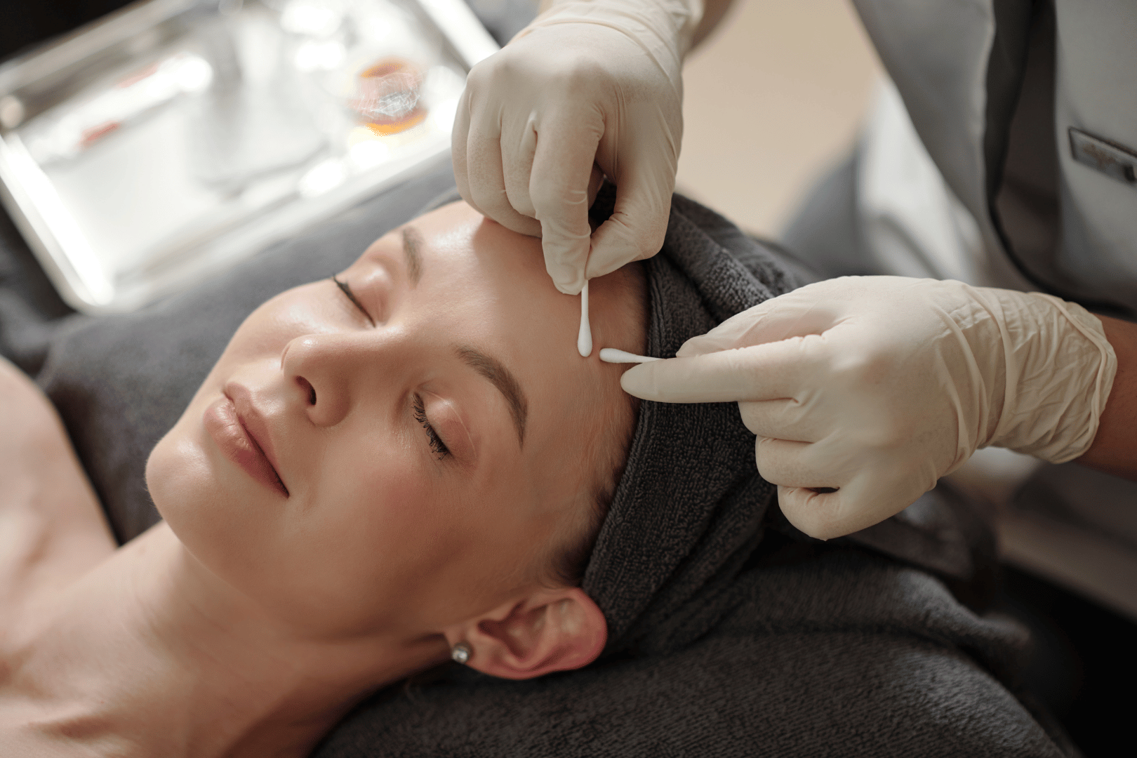 acne treatment for woman