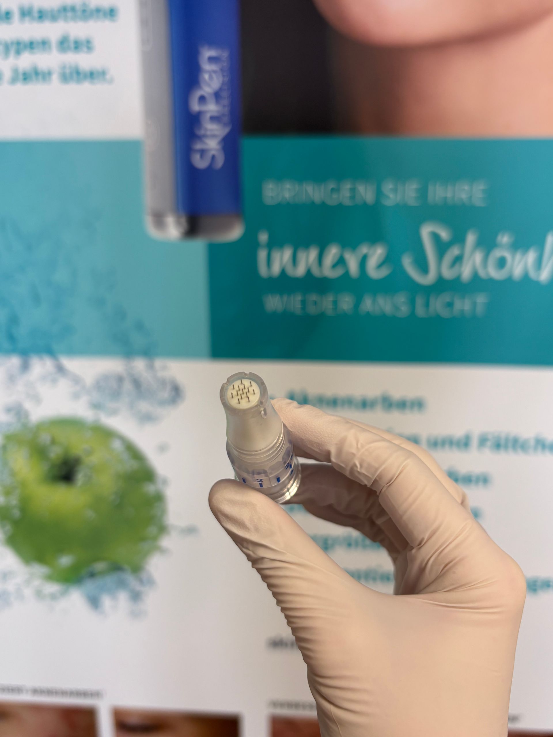 Natürliche Hautverjüngung durch Repair mit Polynukleotiden und Medical Needling