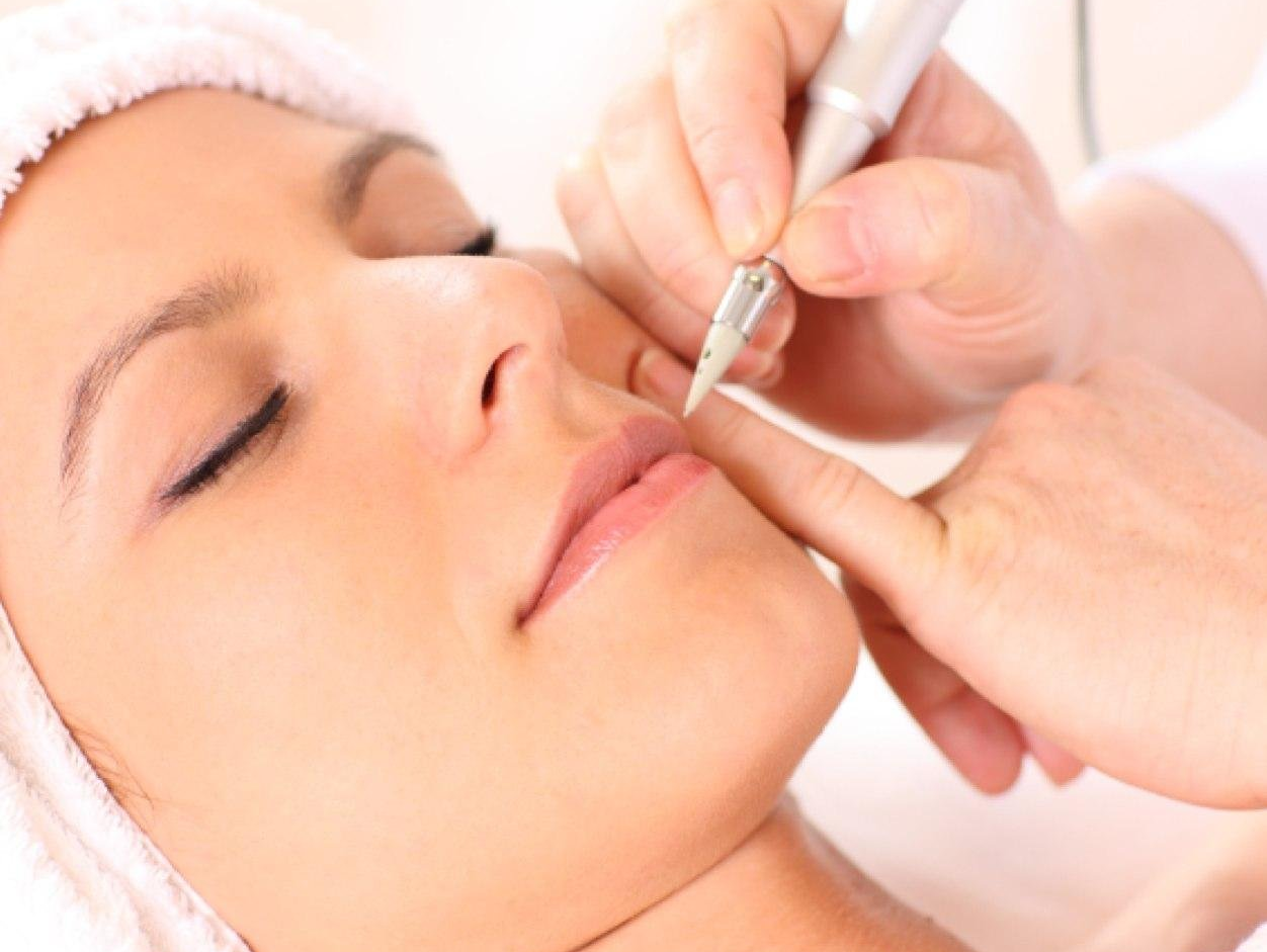 Electrolysis - Beautician in Walkinstown, Dublin 12