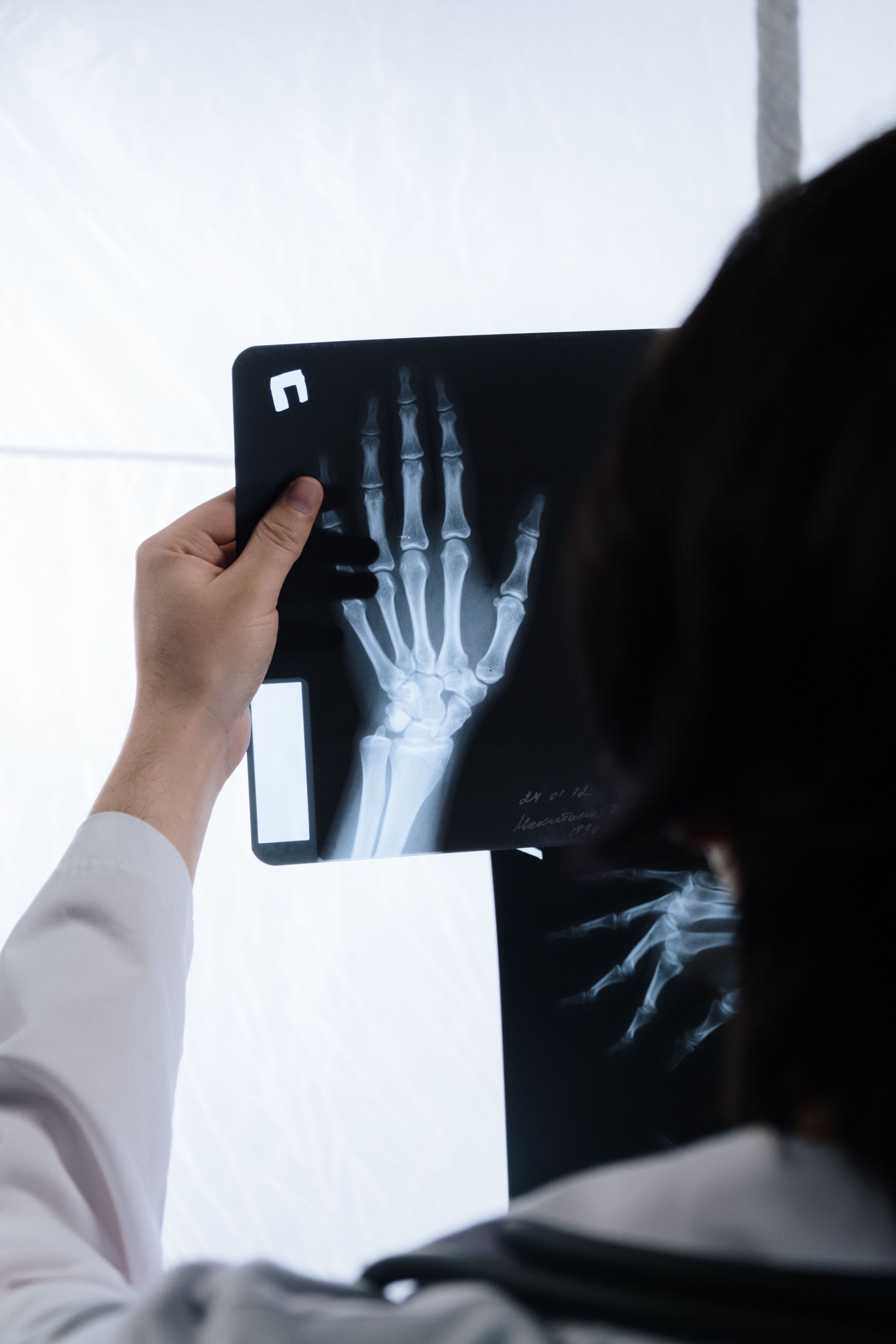 Doctor holding a hand X-ray film up to the light for examination
