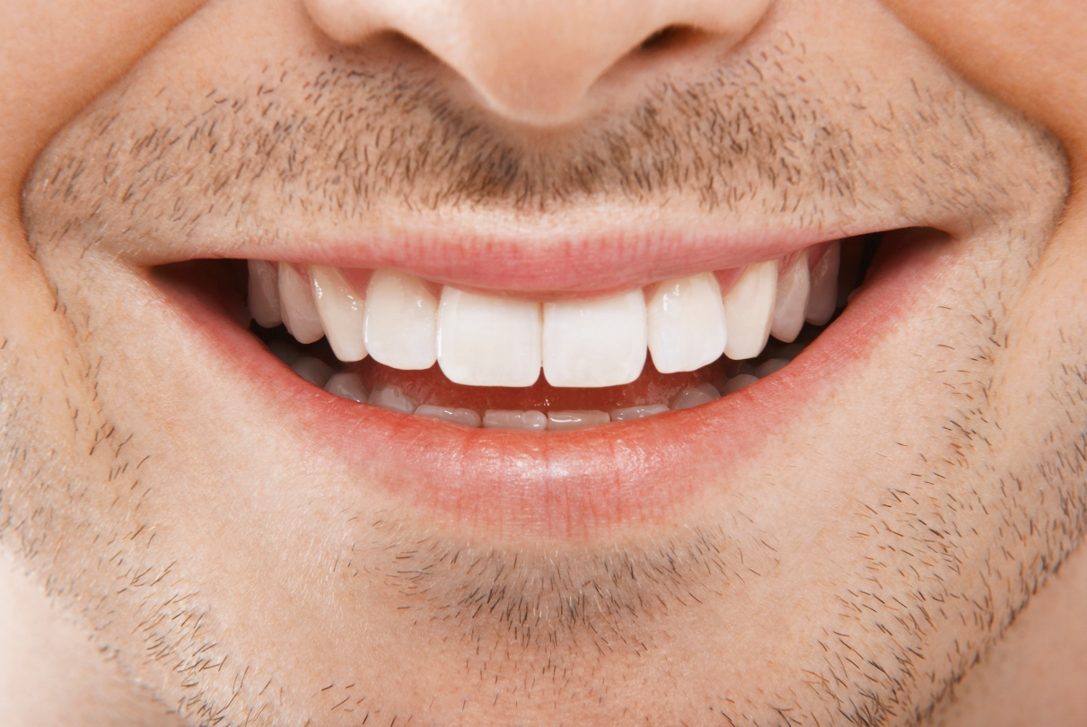 Close-up of a smiling mouth with bright white teeth and a thin mustache.