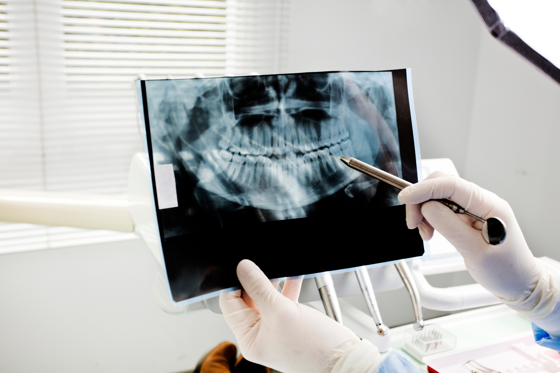 Dentist in gloves pointing to teeth on an X-ray in a dental office.