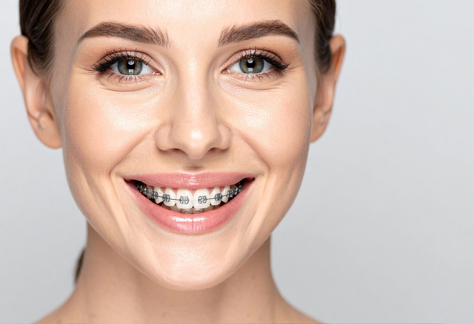 Woman smiling, showing dental braces. Light skin, gray eyes, against a gray background.