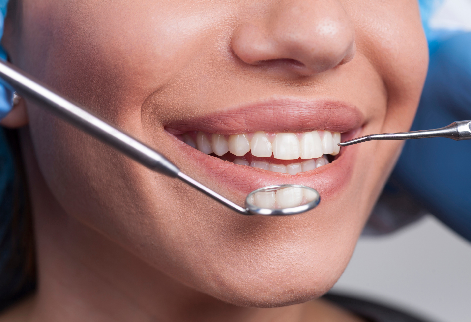 Woman's smiling mouth being examined with dental tools, showing white teeth, in a dental office.