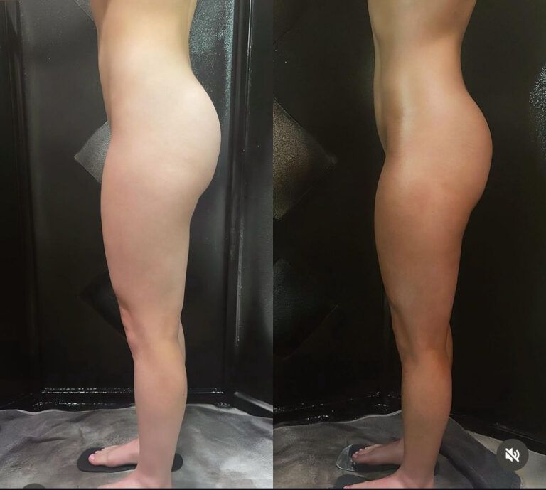 Two side-view photos of a person's legs and torso, before and after a tan, showing a color change.