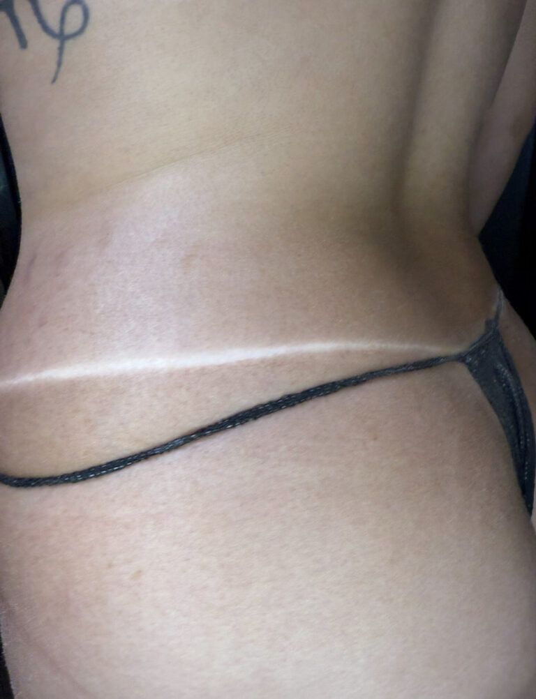 Back of a person with a tan line from wearing a thong swimsuit. White line across the back.