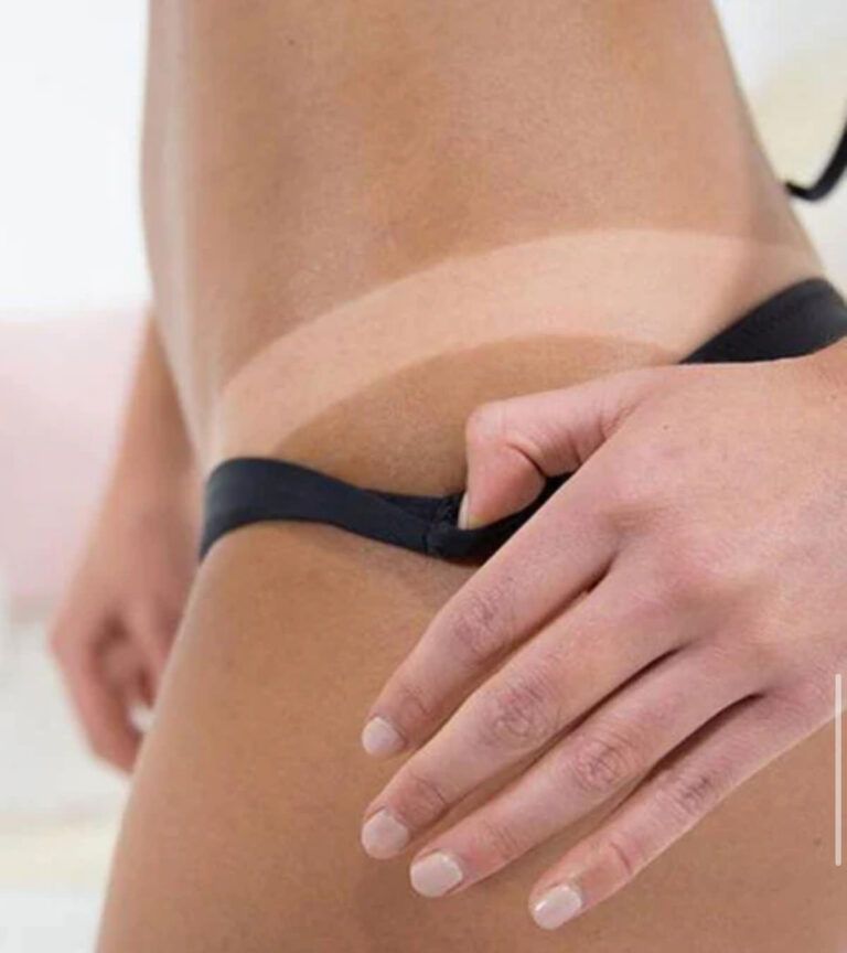 Person in black bikini, tan line visible on hip and thigh. Hand rests on hip.