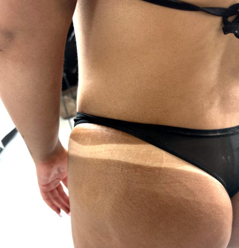 Person's back and hip in black lingerie, side view. Back and hip are tan, lit by sunlight.