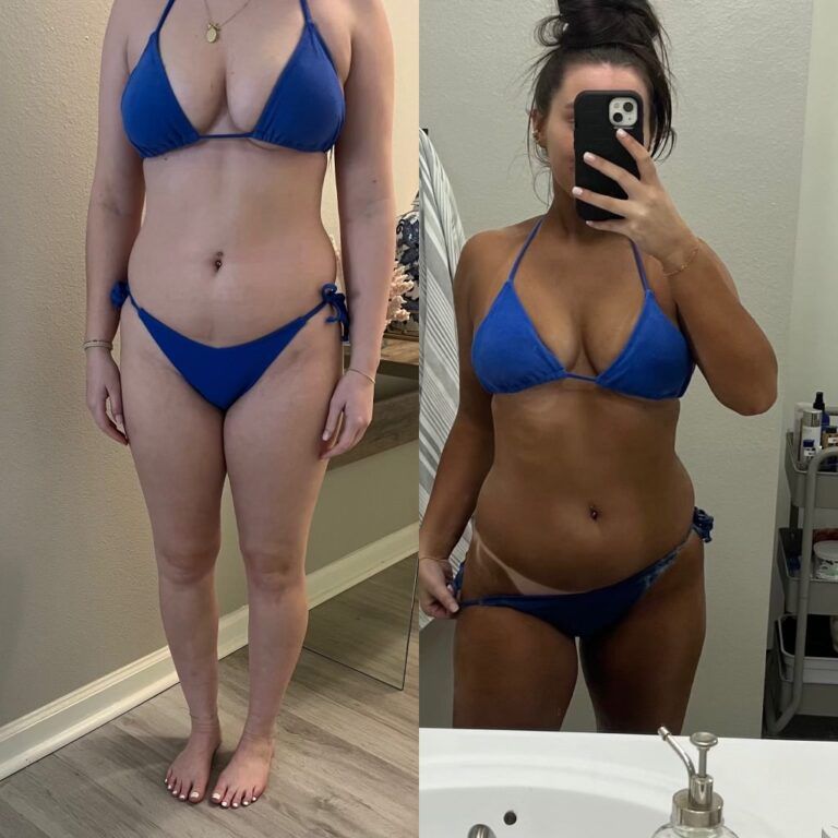 Comparison of a woman in a blue bikini before and after a spray tan.