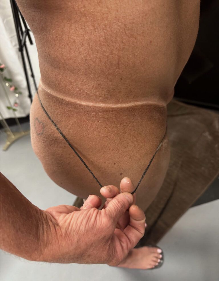 Person's tan line showing where bikini bottoms were. A hand is holding the bikini's string.