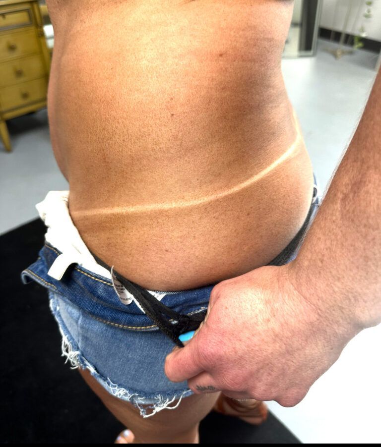 Person's torso with prominent tan lines, wearing denim shorts. Someone's hand is near the shorts.