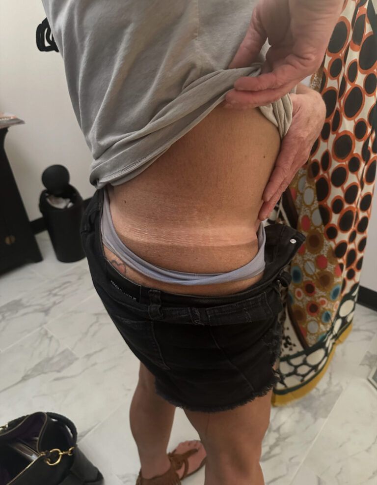 Woman's side with tan lines from shorts and underwear visible, standing indoors.