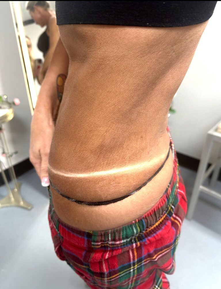 Person with tan lines on their side, wearing a black top and plaid pants.