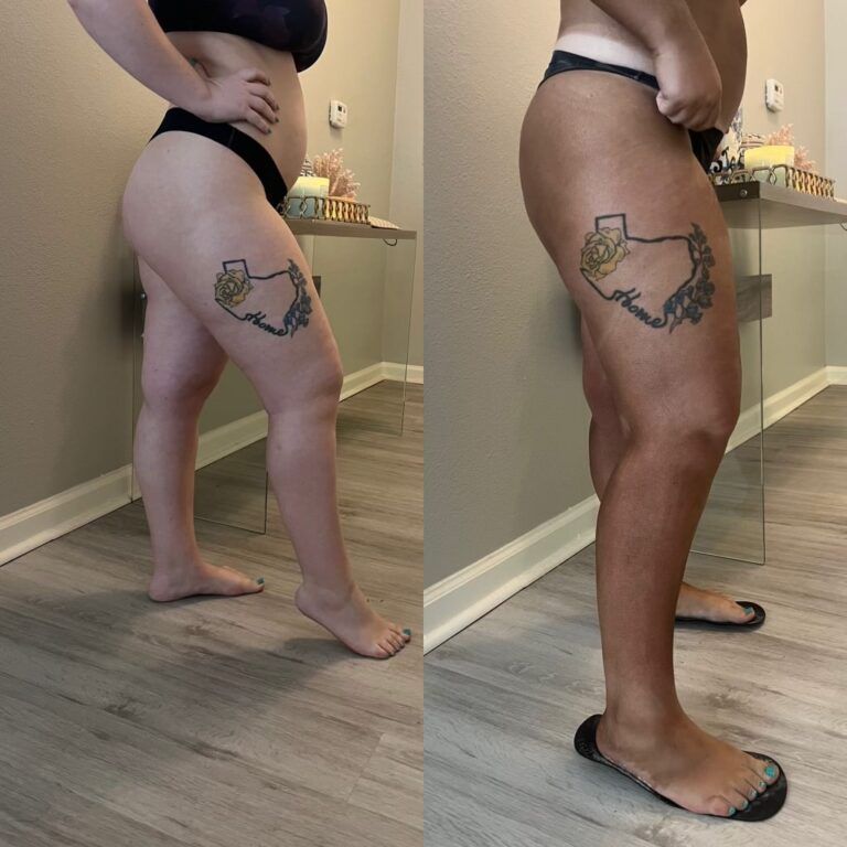 Two photos of a person, before and after, showing a change in skin tone. They have a Texas tattoo and are in underwear.