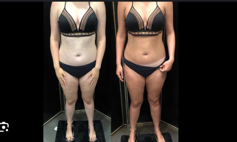 Two photos: pale person on the left, tanned person on the right, both in black lingerie.