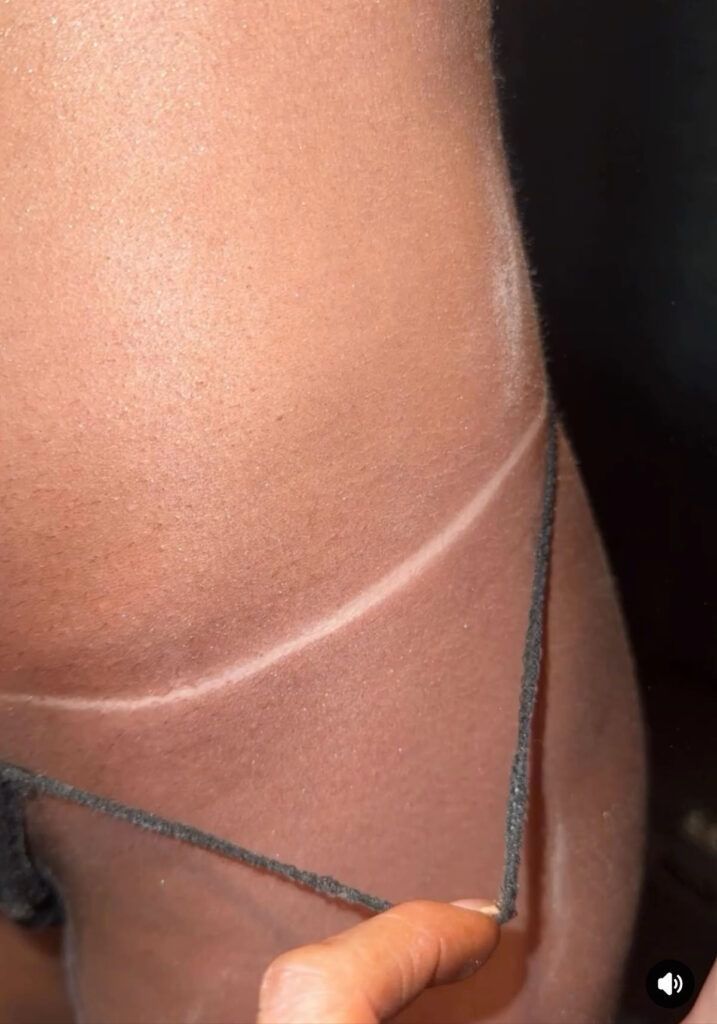 Close-up of a person's skin with a tan line from a thong-style bikini. A hand holds the string.