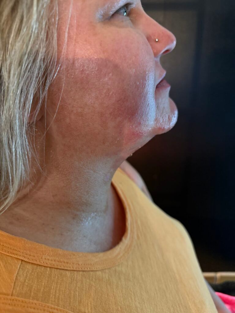 Woman with fair skin looking upward, slight smile, wearing a yellow tank top.