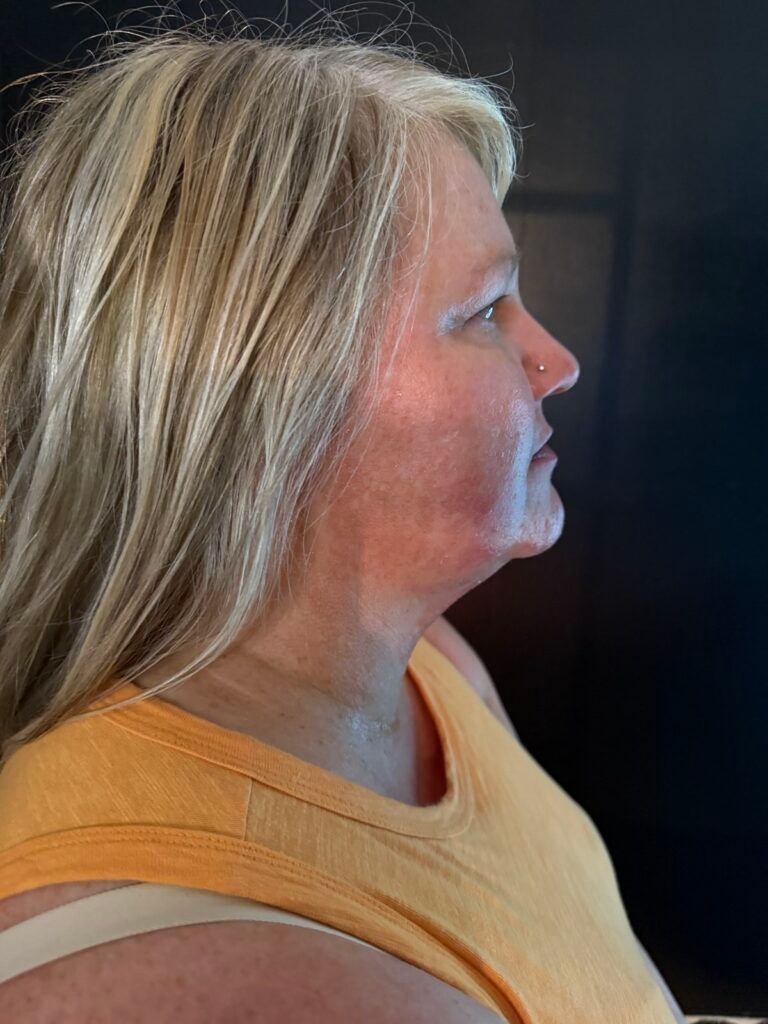 Woman with blonde hair, wearing an orange tank top, facing right, with visible double chin.