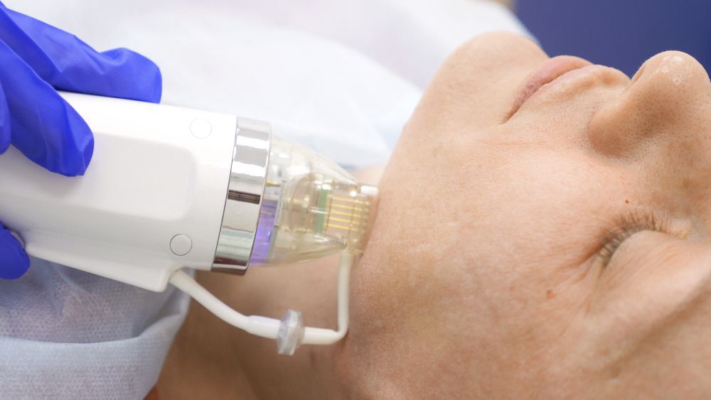 A woman is getting a facial treatment with a machine on her face.